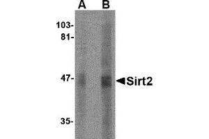 Western Blotting (WB) image for anti-Sirtuin 2 (SIRT2) (N-Term) antibody (ABIN1031568) (SIRT2 antibody  (N-Term))