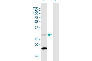Western Blot analysis of C18orf55 expression in transfected 293T cell line ( H00029090-T01 ) by C18orf55 MaxPab polyclonal antibody. (TIMM21 antibody  (AA 1-248))