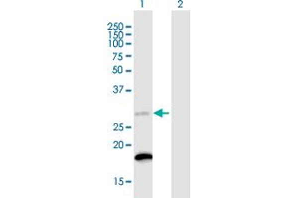 TIMM21 anticorps  (AA 1-248)