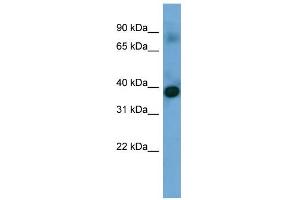 WB Suggested Anti-SFXN4 Antibody Titration: 0. (Sideroflexin 4 antibody  (N-Term))