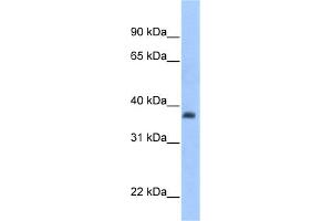WB Suggested Anti-ST3GAL2 Antibody Titration:  0. (ST3GAL2 antibody  (C-Term))