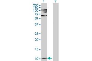 Western Blot analysis of PTH expression in transfected 293T cell line by PTH MaxPab polyclonal antibody. (PTH antibody  (AA 1-115))