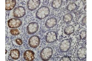 Image no. 1 for anti-EPH Receptor B3 (EPHB3) (AA 899-998) antibody (ABIN598667) (EPH Receptor B3 antibody  (AA 899-998))