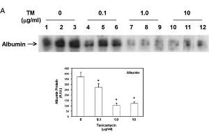 Western Blot of Anti-Human Serum Albumin Antibody. (Albumin antibody)