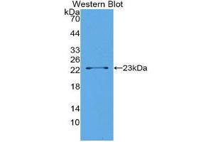 Western Blotting (WB) image for anti-Lipolysis Stimulated Lipoprotein Receptor (LSR) (AA 335-589) antibody (ABIN1176166) (LSR antibody  (AA 335-589))