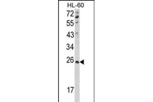 NME4 antibody  (C-Term)