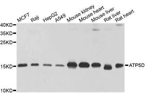Western blot analysis of extracts of various cell lines, using ATP5D antibody. (ATP5F1D antibody  (AA 1-168))