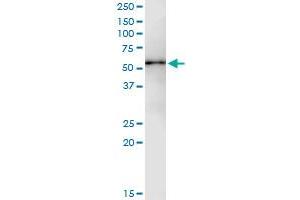 Immunoprecipitation of PPM1F transfected lysate using anti-PPM1F MaxPab rabbit polyclonal antibody and Protein A Magnetic Bead , and immunoblotted with PPM1F purified MaxPab mouse polyclonal antibody (B01P) . (PPM1F antibody  (AA 1-454))