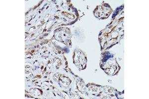 Immunohistochemistry of paraffin-embedded human placenta using PLK1 Rabbit pAb (ABIN3023351, ABIN3023352, ABIN3023353 and ABIN6219645) at dilution of 1:100 (40x lens).