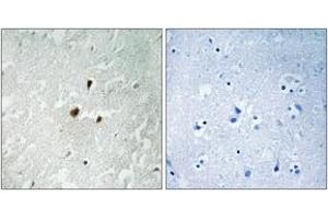 Immunohistochemistry analysis of paraffin-embedded human brain, using TIF-IA (Phospho-Ser649) Antibody. (RRN3 antibody  (pSer649))