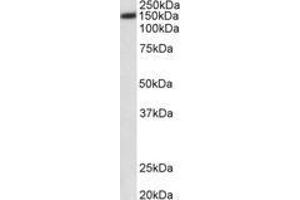 Image no. 1 for anti-ATPase, Ca++ Transporting, Plasma Membrane 1 (ATP2B1) (AA 312-327) antibody (ABIN1100135)