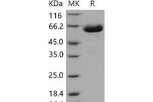 EPH Receptor B1 Protein (EPHB1) (His tag)