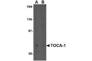 Image no. 1 for anti-Formin Binding Protein 1-Like (FNBP1L) (N-Term) antibody (ABIN1494383)