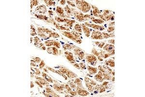 Immunohistochemical analysis of paraffin-embedded H. (ZNF175 antibody  (N-Term))