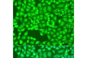 Immunofluorescence analysis of U2OS cells using FLT4 Polyclonal Antibody at dilution of 1:100. (FLT4 antibody)