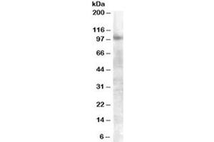 Western blot testing of A549 lysate with FGFR2 antibody at 0. (FGFR2 antibody)