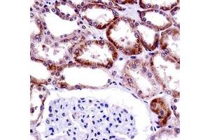 CD70 antibody immunohistochemistry analysis in formalin fixed and paraffin embedded human kidney tissue. (CD70 antibody  (AA 72-101))