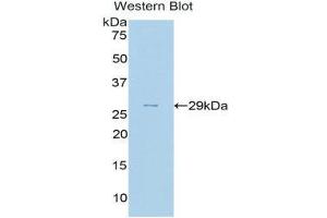 Western Blotting (WB) image for anti-Complement Factor H (CFH) (AA 975-1217) antibody (ABIN3208198)