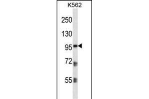PKP2 Antibody (C-term) (ABIN656864 and ABIN2846068) western blot analysis in K562 cell line lysates (35 μg/lane).