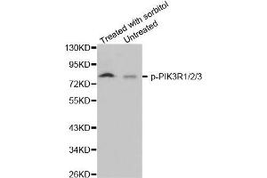 Western blot analysis of extracts from 293 cells, using phospho-PIK3R1/2/3-Y467 antibody (PIK3R1 + PIK3R2 + PIK3R3 (pTyr467) antibody)