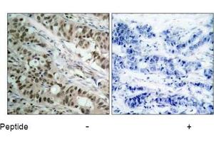 Image no. 3 for anti-Forkhead Box O1 (FOXO1) (AA 254-258) antibody (ABIN197334) (FOXO1 antibody  (AA 254-258))