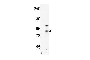 Western blot analysis of CTNB1 (arrow) using rabbit polyclonal CTNB1 Antibody (C-term) (ABIN655178 and ABIN2844795). (CTNNB1 antibody  (C-Term))