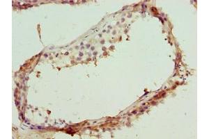 Immunohistochemistry of paraffin-embedded human testis tissue using ABIN7171810 at dilution of 1:100 (TEX35 antibody  (AA 1-215))