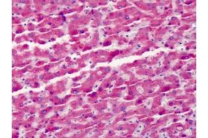 Human Liver: Formalin-Fixed, Paraffin-Embedded (FFPE) (Vitamin D-Binding Protein antibody)