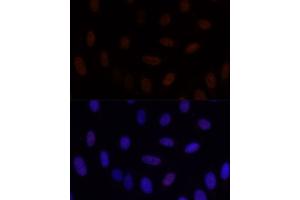 Immunofluorescence analysis of U-2 OS cells using GLI2 antibody (ABIN7267384) at dilution of 1:100. (GLI2 antibody)