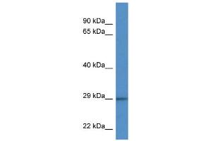 WB Suggested Anti-F11R Antibody Titration: 1. (F11R antibody  (C-Term))