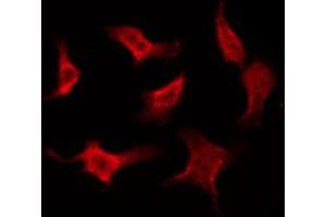 ABIN6268815 staining Hela by IF/ICC. (Caspase 8 antibody  (Cleaved-Asp384))