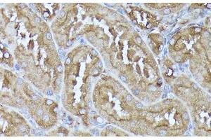 Immunohistochemistry of paraffin-embedded Rat kidney using DLAT Polyclonal Antibody at dilution of 1:100 (40x lens). (DLAT antibody)
