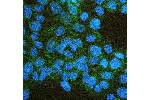 IF analysis of IFNAR2 using anti-IFNAR2 antibody (ABIN7601353). (IFNAR2 antibody  (AA 33-466))