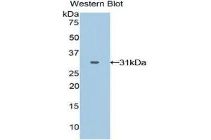 Western blot analysis of the recombinant protein. (GRAP2 antibody  (AA 15-247))