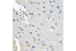 Immunohistochemistry of paraffin-embedded mouse brain using PKN1 antibody (ABIN6003498) at dilution of 1/100 (40x lens). (PKN1 antibody)