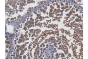 Detection of Sp17 in Mouse Testis Tissue using Polyclonal Antibody to Sperm Protein 17 (Sp17) (SPA17 antibody  (AA 1-149))