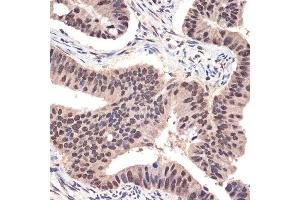 Immunohistochemistry of paraffin-embedded human colon carcinoma using EHMT2 Rabbit mAb (ABIN7265616) at dilution of 1:100 (40x lens). (EHMT2 antibody)