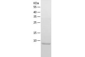 Western Blotting (WB) image for Chemokine (C-X-C Motif) Receptor 4 (CXCR4) (AA 1-46) protein (His tag) (ABIN7286626) (CXCR4 Protein (AA 1-46) (His tag))