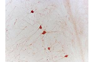 Formalin-fixed and paraffin embedded mouse hippocampus labeled with Rabbit Anti-phospho-CREB-1(Ser133) Polyclonal Antibody, Unconjugated 1:500 followed by conjugation to the secondary antibody (CREB1 antibody  (pSer133))