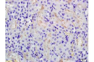 Formalin-fixed and paraffin embedded mouse kidney labeled with Anti-RHCG Polyclonal Antibody, Unconjugated (ABIN872934) at 1:200 followed by conjugation to the secondary antibody and DAB staining.