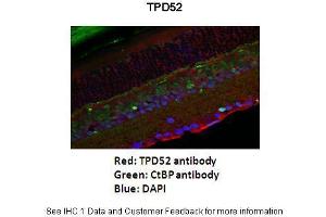 Application: Immunofluorescence Species+tissue/cell type: Mouse retina Primary antibody dilution: 1:200 Secondary antibody: Goat anti-rabbit Alexafluor 568 Secondary antibody dilution: 1:200 - See more at: (TPD52 antibody  (Middle Region))