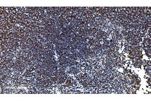 IHC analysis of CDC45L using anti-CDC45L antibody (ABIN7600230). (CDC45 antibody  (AA 166-431))