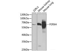 Western blot analysis of extracts of various cell lines using P2RX4 Polyclonal Antibody at dilution of 1:1000.