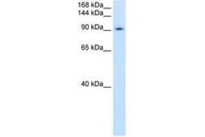 Image no. 1 for anti-DEAD (Asp-Glu-Ala-Asp) Box Polypeptide 54 (DDX54) (AA 661-710) antibody (ABIN6736604) (DDX54 antibody  (AA 661-710))