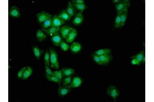 Immunofluorescence staining of HepG2 cells with ABIN7159817 at 1:100, counter-stained with DAPI. (OGN antibody  (AA 21-298))
