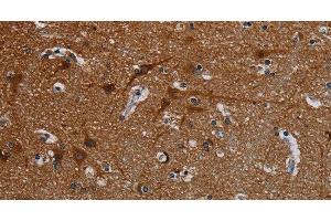 Immunohistochemistry of paraffin-embedded Human brain tissue using PCDHB15 Polyclonal Antibody at dilution 1:50 (PCDHB15 antibody)