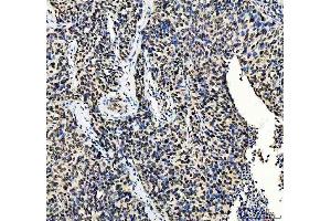 IHC analysis of MTA2 using anti-MTA2 antibody (ABIN7599519). (MTA2 antibody  (AA 1-668))