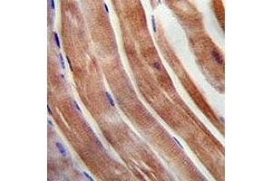KEAP1 antibody immunohistochemistry analysis in formalin fixed and paraffin embedded human skeletal muscle. (KEAP1 antibody  (AA 422-449))