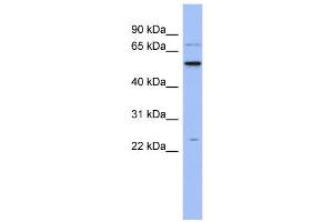WB Suggested Anti-ZCRB1 Antibody Titration:  0. (ZCRB1 antibody  (N-Term))