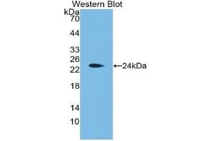 Western Blotting (WB) image for anti-Aggrecan (ACAN) (AA 2163-2316) antibody (ABIN1175194) (Aggrecan antibody  (AA 2163-2316))